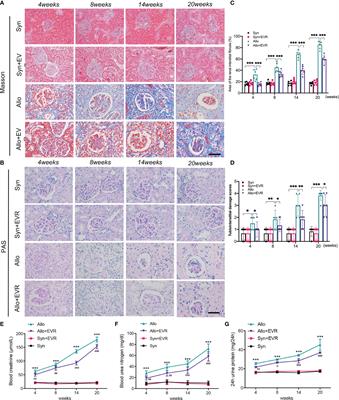 Everolimus Alleviates Renal Allograft Interstitial Fibrosis by Inhibiting Epithelial-to-Mesenchymal Transition Not Only via Inducing Autophagy but Also via Stabilizing IκB-α